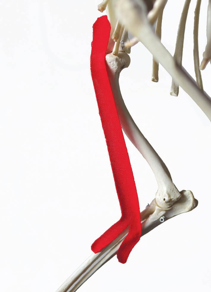 Y-shaped tape positioned along the biceps brachii, shown on a skeleton