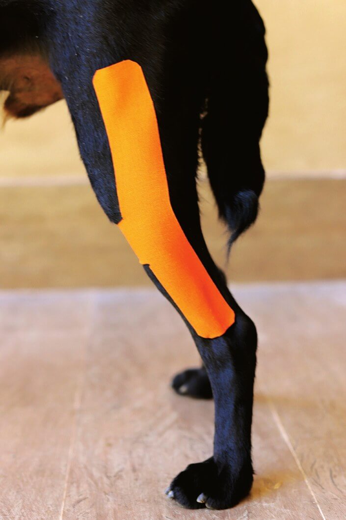 H tape applied with strong stretch, lateral view