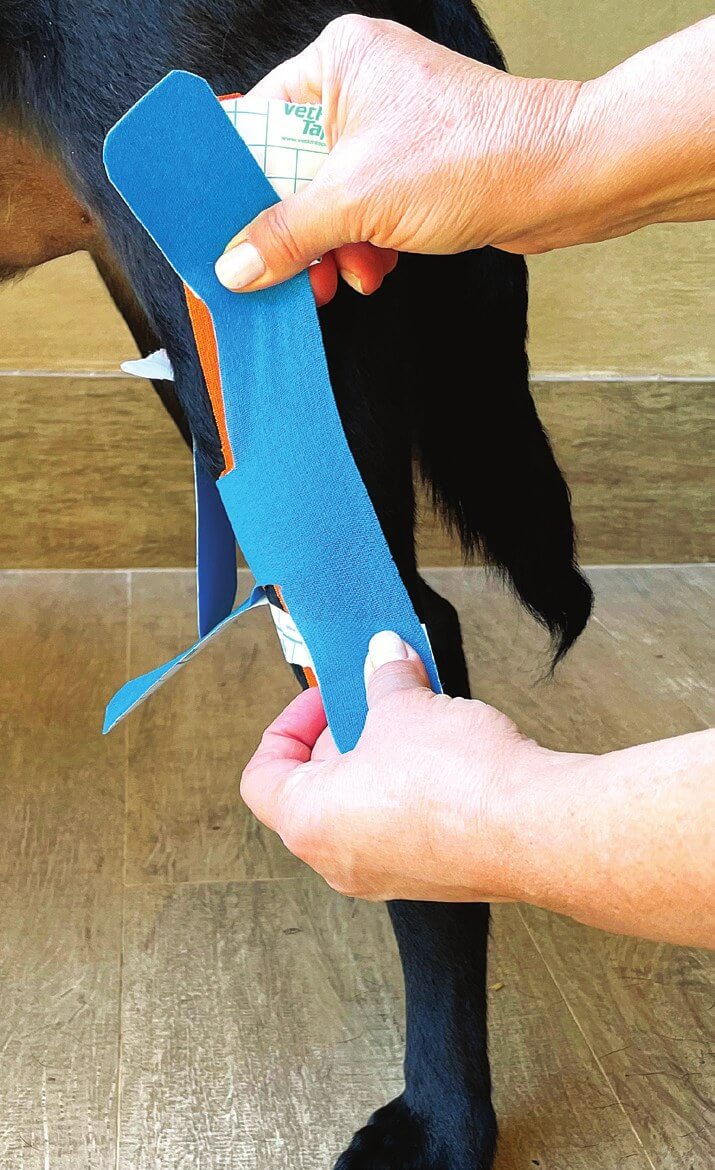 Applying a second reinforcing H tape, lateral view