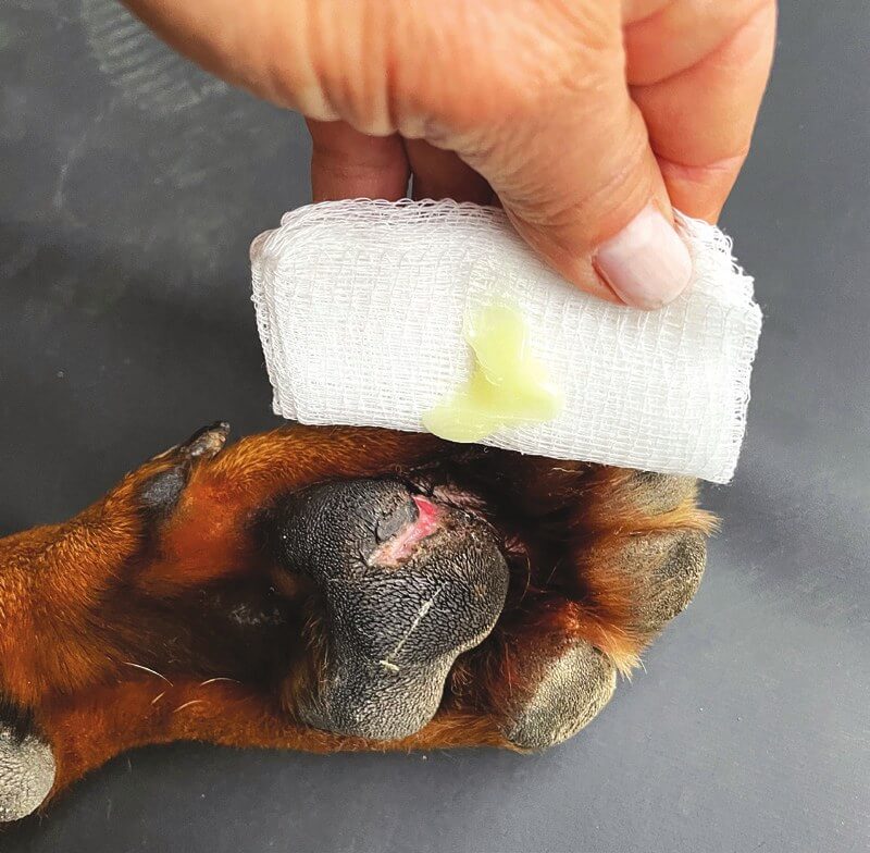 Applying gauze with antibiotic ointment to a digital pad wound