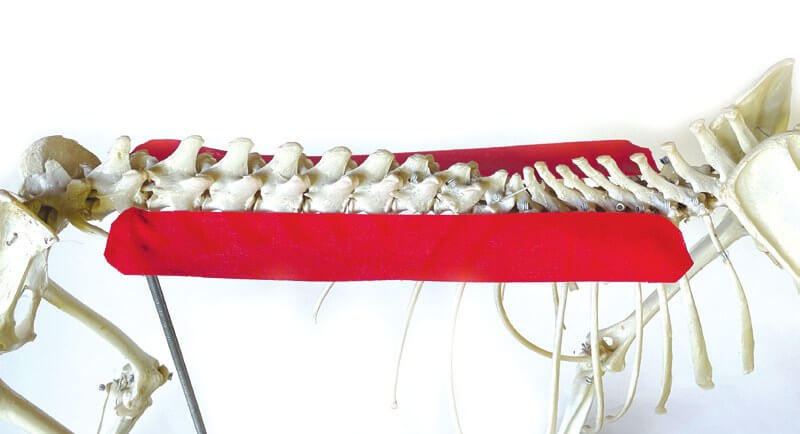 Tape position over the erector spinae muscle, shown on a skeleton