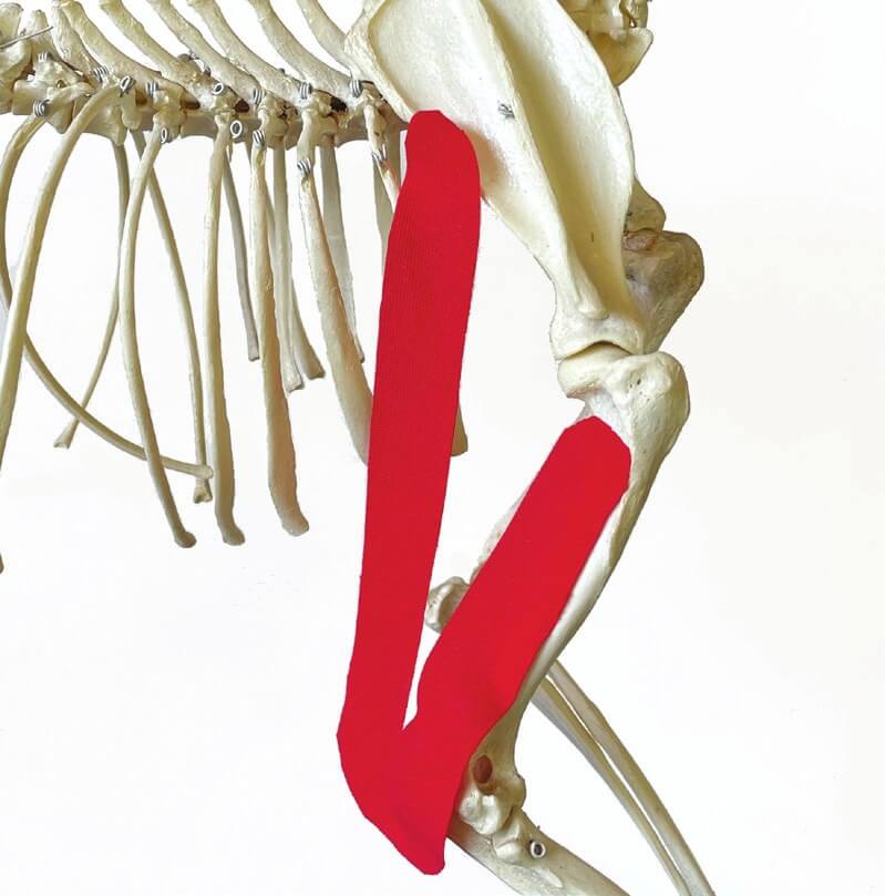 Tape position over the triceps brachii muscle, shown on a skeleton