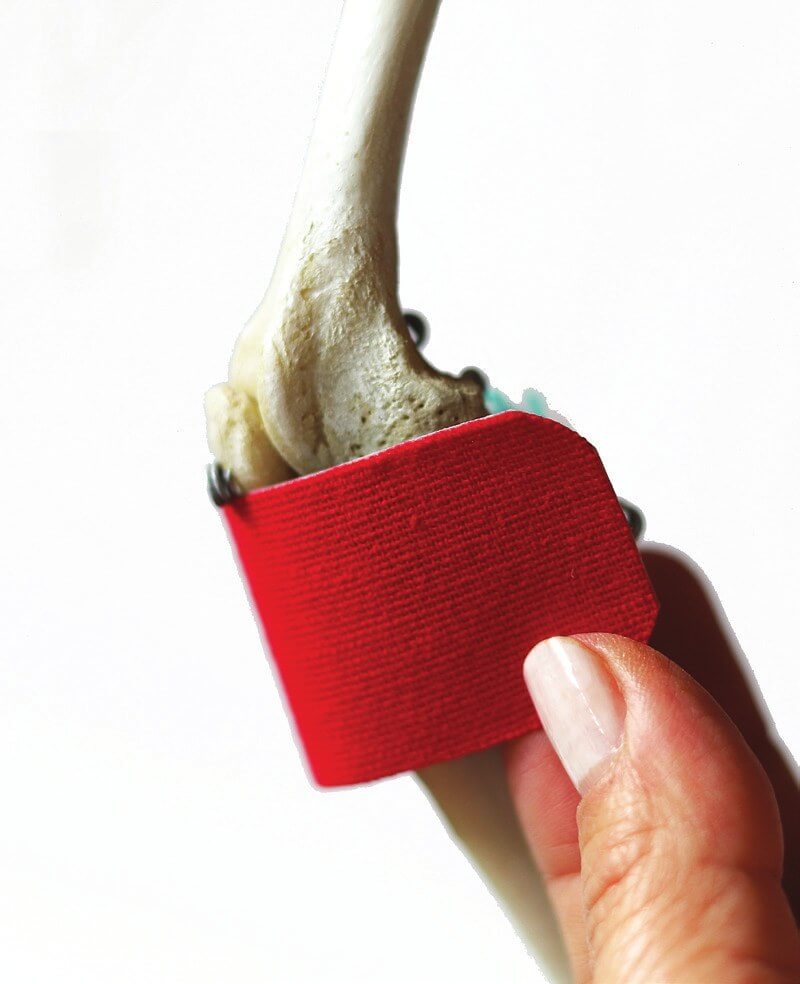 Position of the tape over the patellar tendon, shown on a skeleton