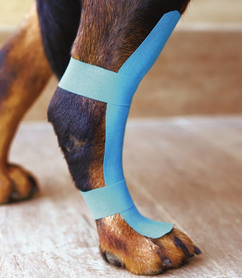 Simple I-shape tape applied for proprioception