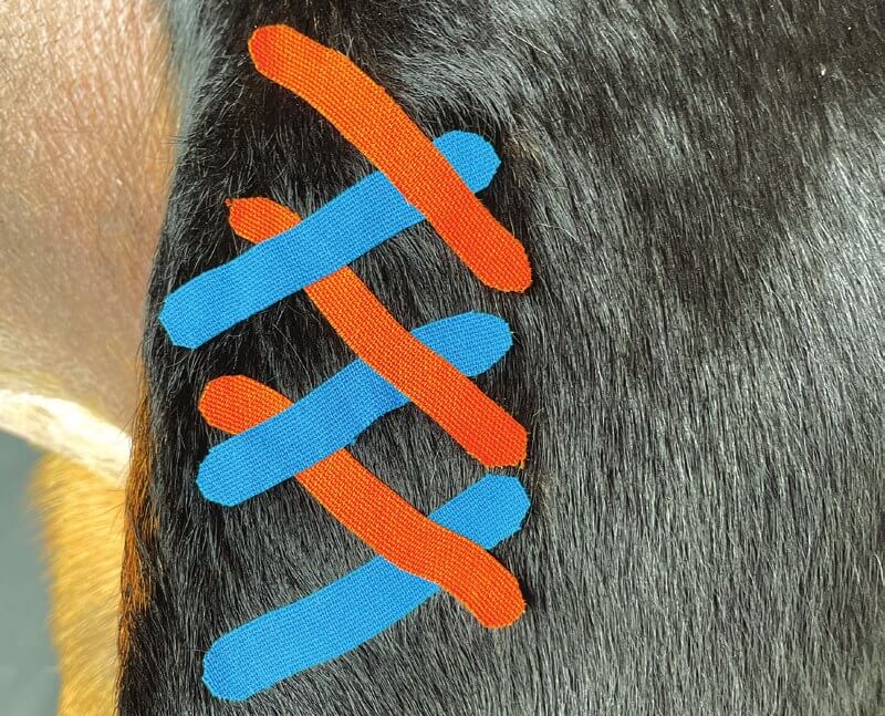 Crisscross I-tape pattern applied over scar tissue