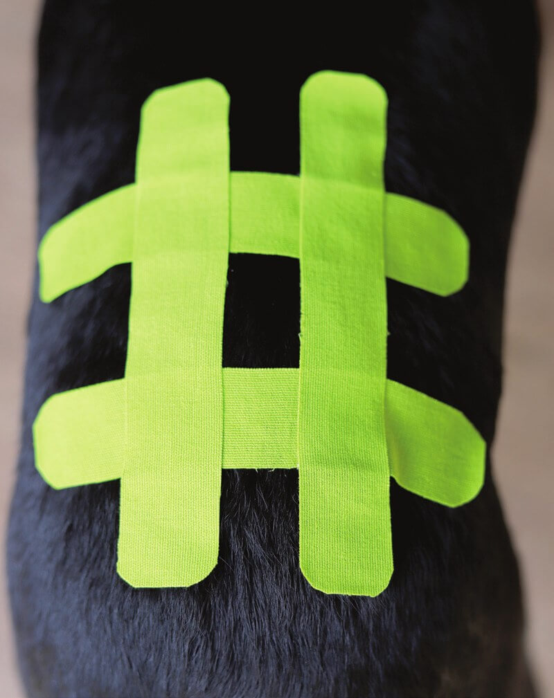 Hashtag technique combining I-shaped kinesiology tape cuts