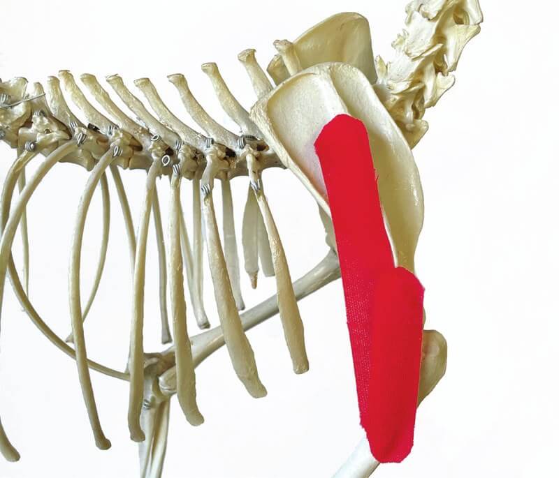 Tape-Position über dem Deltoideus-Muskel, am Skelett dargestellt
