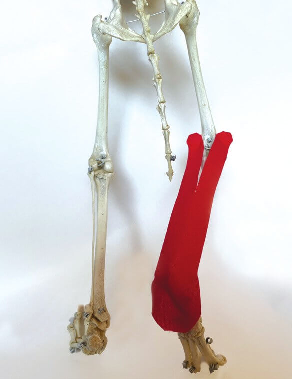 Tape-Position über dem Gastrocnemius-Muskel, am Skelett dargestellt